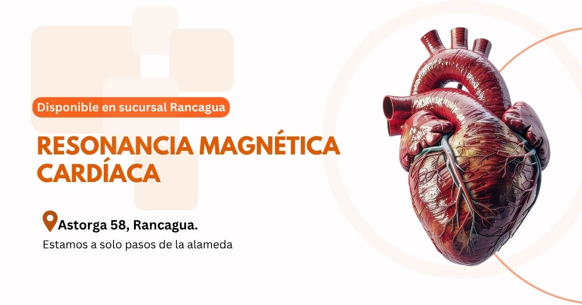 Exámenes de resonancia magnetica cerebro