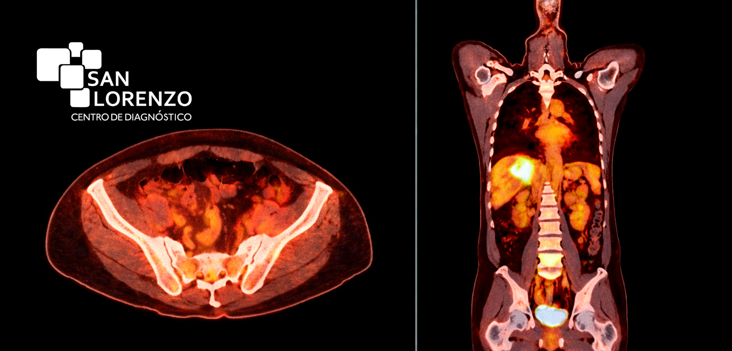 Exámenes oncológicos rancagua